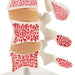 Image 6 - DELUXE HUMAN OSTEOPOROSIS MODEL (3 VERTEBRAE WITH DISCS ), REMOVABLE ON STAND - 3B SMART ANATOMY