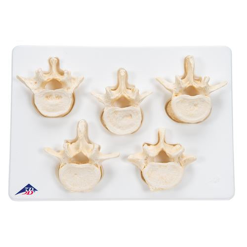 Image 3 - SET OF 5 BONELIKE™ LUMBAR VERTEBRAE - 3B SMART ANATOMY