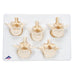 Image 3 - SET OF 5 BONELIKE™ LUMBAR VERTEBRAE - 3B SMART ANATOMY