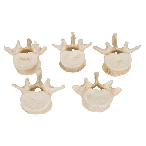 Image 4 - SET OF 5 BONELIKE™ LUMBAR VERTEBRAE - 3B SMART ANATOMY