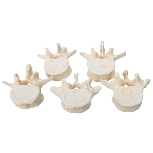 Image 5 - SET OF 5 BONELIKE™ LUMBAR VERTEBRAE - 3B SMART ANATOMY