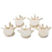 Image 5 - SET OF 5 BONELIKE™ LUMBAR VERTEBRAE - 3B SMART ANATOMY