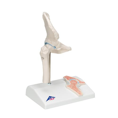 Image 3 - MINI HUMAN HIP JOINT MODEL WITH CROSS SECTION - 3B SMART ANATOMY