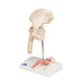 Image 5 - HUMAN FEMORAL FRACTURE & HIP OSTEOARTHRITIS MODEL - 3B SMART ANATOMY