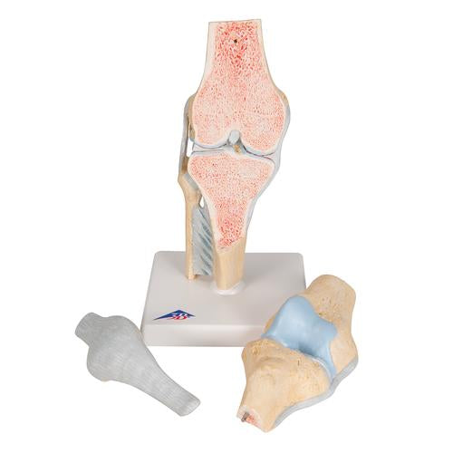 Image 6 - SECTIONAL HUMAN KNEE JOINT MODEL, 3 PART - 3B SMART ANATOMY