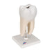 Image 3 - LOWER TWIN-ROOT MOLAR WITH CAVITIES HUMAN TOOTH MODEL, 2 PART - 3B SMART ANATOMY