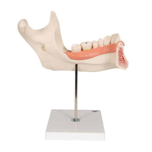 Image 5 - HALF LOWER HUMAN JAW MODEL, 3 TIMES FULL-SIZE, 6 PART - 3B SMART ANATOMY