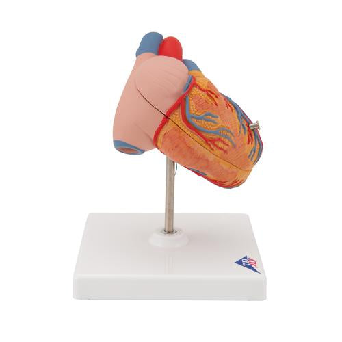 Image 3 - CLASSIC HUMAN HEART MODEL WITH LEFT VENTRICULAR HYPERTROPHY (LVH), 2 PART - 3B SMART ANATOMY