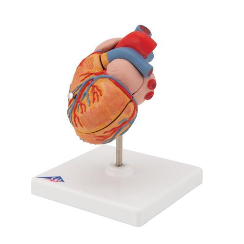 Image 6 - CLASSIC HUMAN HEART MODEL WITH LEFT VENTRICULAR HYPERTROPHY (LVH), 2 PART - 3B SMART ANATOMY