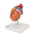 Image 6 - CLASSIC HUMAN HEART MODEL WITH LEFT VENTRICULAR HYPERTROPHY (LVH), 2 PART - 3B SMART ANATOMY