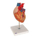 Image 3 - HUMAN HEART MODEL WITH BYPASS, 2 TIMES LIFE-SIZE, 4 PART - 3B SMART ANATOMY