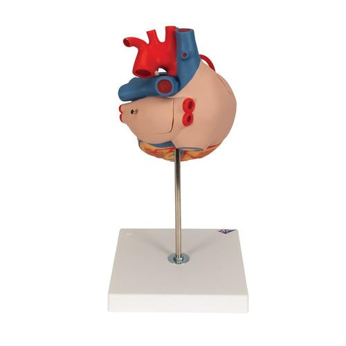 Image 5 - HUMAN HEART MODEL WITH BYPASS, 2 TIMES LIFE-SIZE, 4 PART - 3B SMART ANATOMY