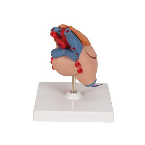 Image 4 - CLASSIC HUMAN HEART MODEL WITH THYMUS, 3 PART - 3B SMART ANATOMY