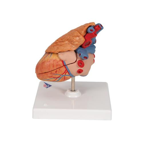 Image 5 - CLASSIC HUMAN HEART MODEL WITH THYMUS, 3 PART - 3B SMART ANATOMY