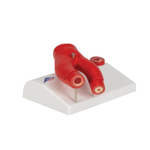 Image 3 - ARTERIOSCLEROSIS MODEL, WITH CROSS SECTION OF ARTERY, 2 PART - 3B SMART ANATOMY