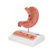 Image 3 - HUMAN STOMACH SECTION MODEL WITH ULCERS - 3B SMART ANATOMY