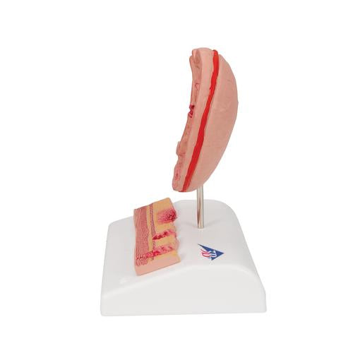 Image 4 - HUMAN STOMACH SECTION MODEL WITH ULCERS - 3B SMART ANATOMY