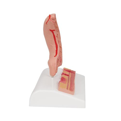 Image 6 - HUMAN STOMACH SECTION MODEL WITH ULCERS - 3B SMART ANATOMY