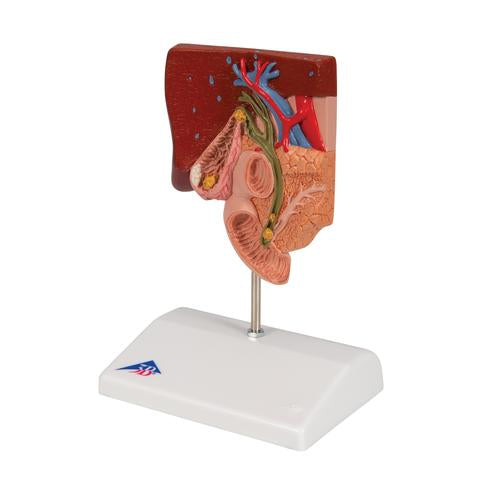 Image 6 - GALLSTONE MODEL - 3B SMART ANATOMY