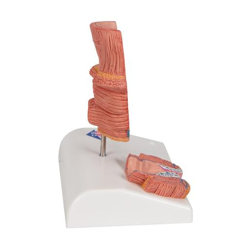 Image 4 - HEMORRHOID MODEL - 3B SMART ANATOMY