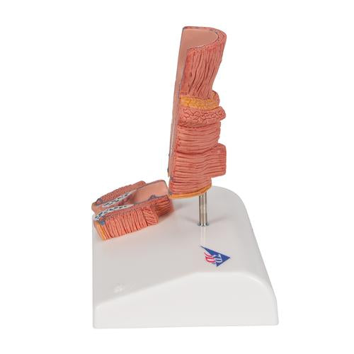 Image 6 - HEMORRHOID MODEL - 3B SMART ANATOMY