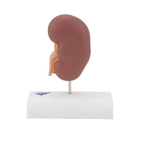 Image 5 - KIDNEY STONE MODEL - 3B SMART ANATOMY