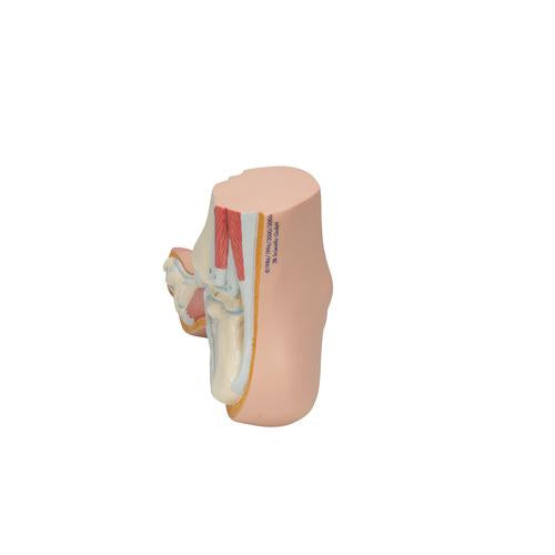 Image 5 - HOLLOW FOOT (PES CAVUS) MODEL - 3B SMART ANATOMY