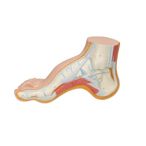 Image 6 - HOLLOW FOOT (PES CAVUS) MODEL - 3B SMART ANATOMY