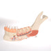 Image 4 - COMPREHENSIVE LOWER JAW MODEL (LEFT HALF) WITH DISEASED TEETH, NERVES, VESSELS & GLANDS, 19 PART - 3B SMART ANATOMY