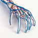 Image 2 - VASCULAR ARM