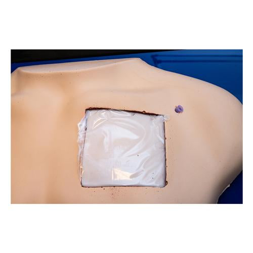 Image 2 - DELUXE VENOUS ACCESS DEVICE MODEL