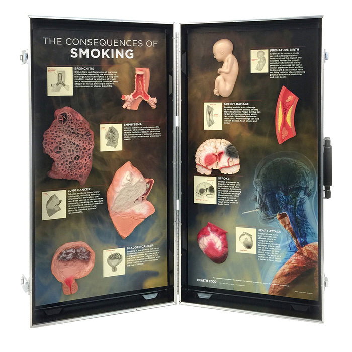 Consequences of Smoking, 3D Info Board