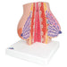 Image 4 - MODEL OF FEMALE BREAST WITH HEALTHY & UNHEALTHY TISSUE - 3B SMART ANATOMY