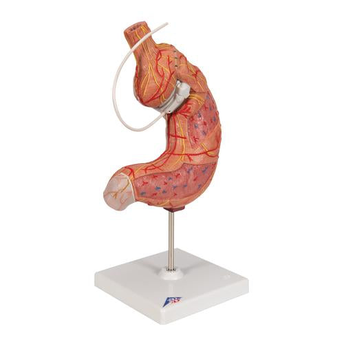 Image 3 - HUMAN STOMACH MODEL WITH GASTRIC BAND, 2 PART - 3B SMART ANATOMY