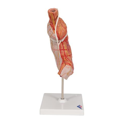 Image 4 - HUMAN STOMACH MODEL WITH GASTRIC BAND, 2 PART - 3B SMART ANATOMY