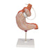 Image 5 - HUMAN STOMACH MODEL WITH GASTRIC BAND, 2 PART - 3B SMART ANATOMY