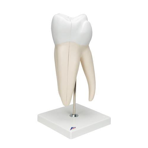 Image 3 - GIANT MOLAR WITH DENTAL CAVITIES HUMAN TOOTH MODEL, 15 TIMES LIFE-SIZE, 6 PART - 3B SMART ANATOMY