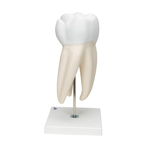 Image 5 - GIANT MOLAR WITH DENTAL CAVITIES HUMAN TOOTH MODEL, 15 TIMES LIFE-SIZE, 6 PART - 3B SMART ANATOMY