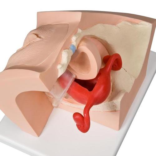 Image 2 - MODEL FOR GYNECOLOGICAL PATIENT EDUCATION - 3B SMART ANATOMY