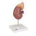 Image 3 - KIDNEY MODEL WITH ADRENAL GLAND, 2 PART - 3B SMART ANATOMY