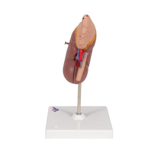 Image 6 - KIDNEY MODEL WITH ADRENAL GLAND, 2 PART - 3B SMART ANATOMY