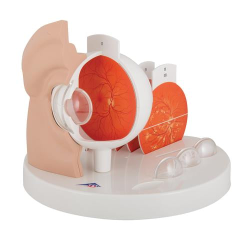 Image 3 - PATHOLOGICAL HUMAN EYE MODEL - 3B SMART ANATOMY