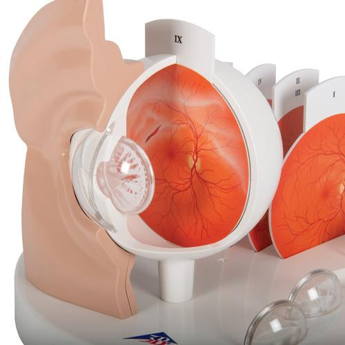 Image 6 - PATHOLOGICAL HUMAN EYE MODEL - 3B SMART ANATOMY