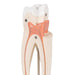 Image 5 - UPPER TRIPLE-ROOT MOLAR HUMAN TOOTH MODEL, 3 PART - 3B SMART ANATOMY