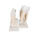 Image 5 - HUMAN TOOTH MODELS SET "CLASSIC SERIES", 5 MODELS - 3B SMART ANATOMY