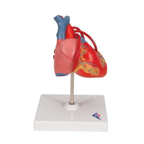 Image 4 - CLASSIC HUMAN HEART MODEL WITH BYPASS, 2 PART - 3B SMART ANATOMY