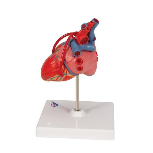 Image 6 - CLASSIC HUMAN HEART MODEL WITH BYPASS, 2 PART - 3B SMART ANATOMY