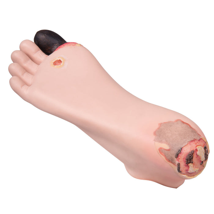 Diabetic Foot Treatment Trainer