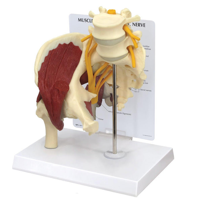 Muscled Hip with Sciatic Nerve