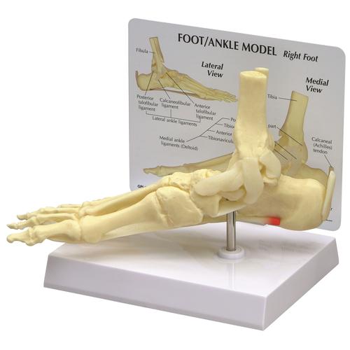 Image 2 - FOOT/ANKLE - PLANTAR FASCIITIS MODEL